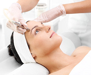 Dermabrasion